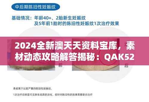 2024全新澳天天资料宝库，素材动态攻略解答揭秘：QAK520.71