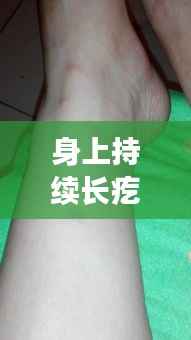 身上持续长疙瘩痒？原因解析与应对策略