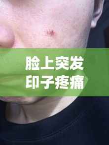 脸上突发印子疼痛原因何在？皮肤问题成因解析与应对方法！